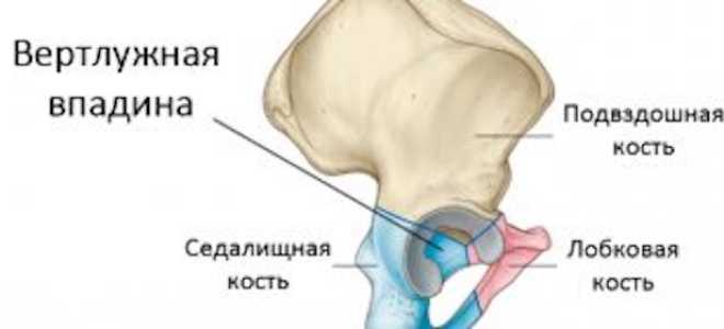 Перелом вертлужной впадины